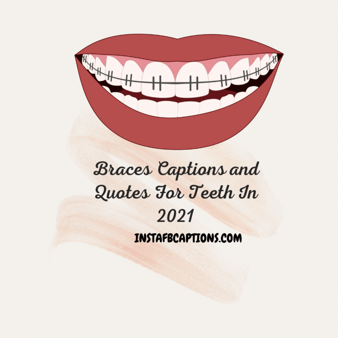 Braces Captions And Quotes For Teeth In 2021